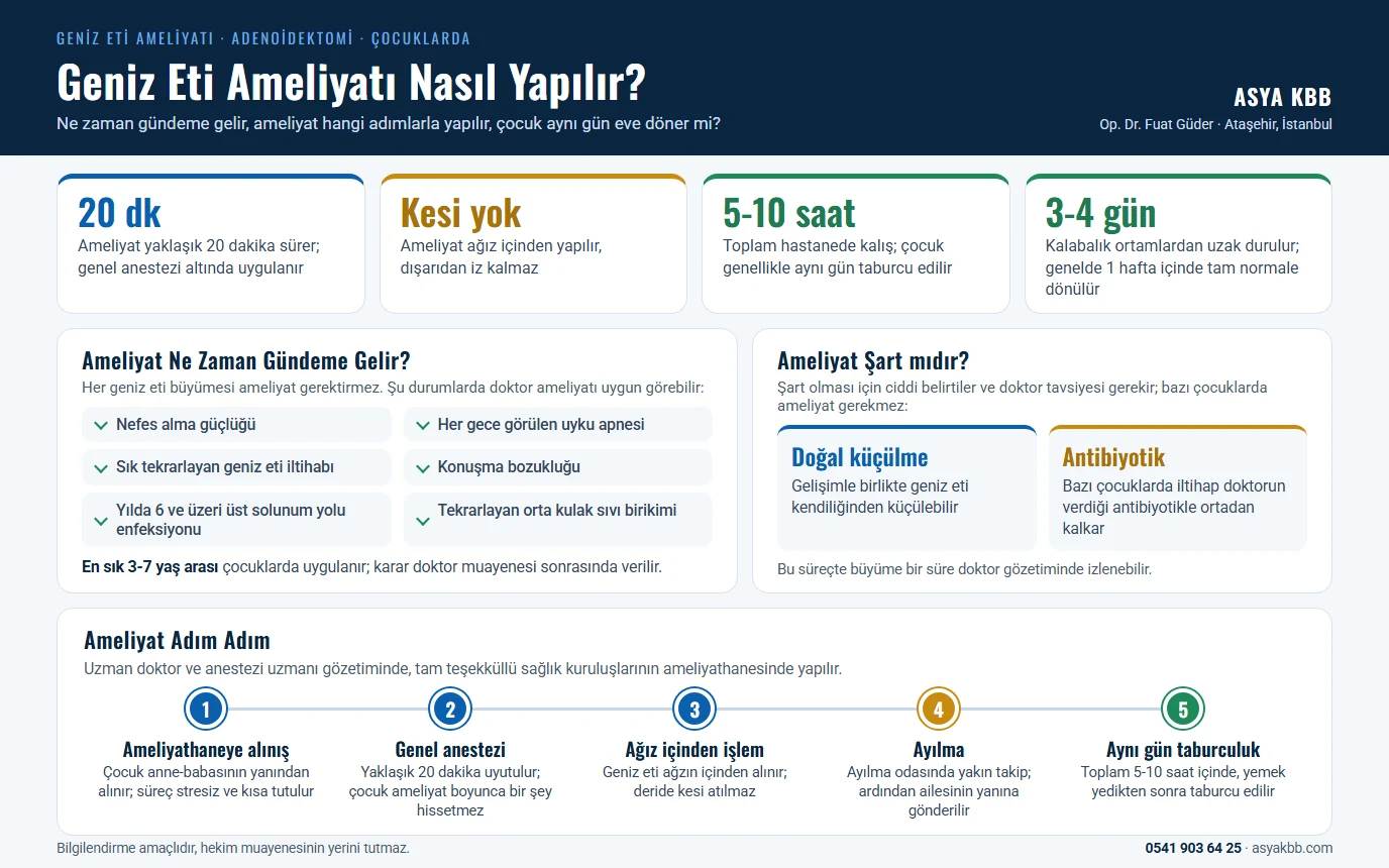 Geniz Eti Ameliyatı 9 Geniz eti ameliyatı nasıl yapılır: ameliyat yaklaşık 20 dakika sürer, genel anestezi altında ağız içinden yapılır, dışarıdan iz kalmaz; toplam hastanede kalış 5-10 saat ve çocuk genellikle aynı gün taburcu edilir; nefes alma güçlüğü, uyku apnesi, sık iltihap gibi durumlarda gündeme gelir; doğal küçülme ve antibiyotik alternatifleri; beş adımda ameliyat; 3-4 gün kalabalık ortamlardan uzak durulur (infografik)