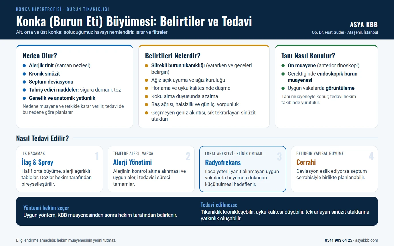 Konka (Burun Eti Büyümesi) Tedavisi 10 Konka (burun eti) büyümesi: nedenler alerjik rinit, kronik sinüzit, septum deviasyonu, tahriş edici maddeler ve genetik yatkınlık; belirtiler sürekli burun tıkanıklığı, ağız açık uyuma, horlama, koku azalması, baş ağrısı ve geniz akıntısı; tanı ön muayene, endoskopik burun muayenesi ve görüntüleme ile konur; tedavi ilaç ve sprey, alerji yönetimi, radyofrekans ve cerrahi seçenekleriyle hekim tarafından planlanır (infografik)