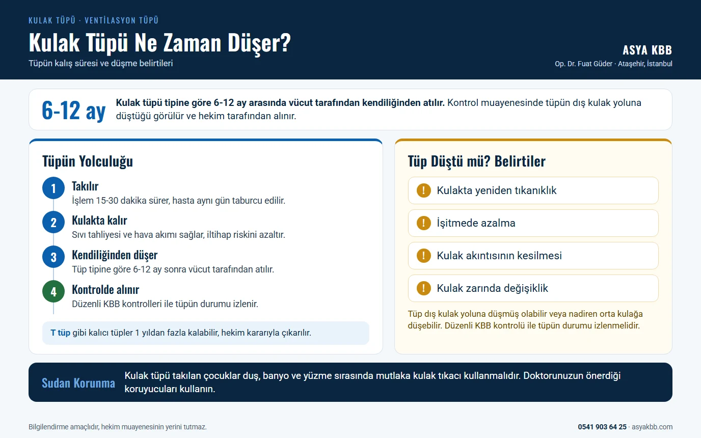 Kulak Tüpü 8 Kulak tüpü ne zaman düşer: tüp tipine göre 6-12 ay arasında vücut tarafından kendiliğinden atılır; tüpün yolculuğu (takılır, kulakta kalır, kendiliğinden düşer, kontrolde alınır), düşme belirtileri (kulakta yeniden tıkanıklık, işitmede azalma, kulak akıntısının kesilmesi, kulak zarında değişiklik), T tüpün 1 yıldan fazla kalabilmesi ve sudan korunma (infografik)