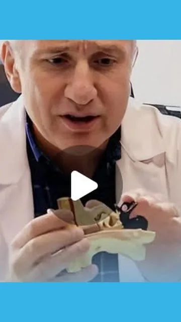 20 Dakikada Vertigo Tedavisi 10 Vertigo: Tedavi ile Üstesinden Gelinir — Instagram reel kapağı